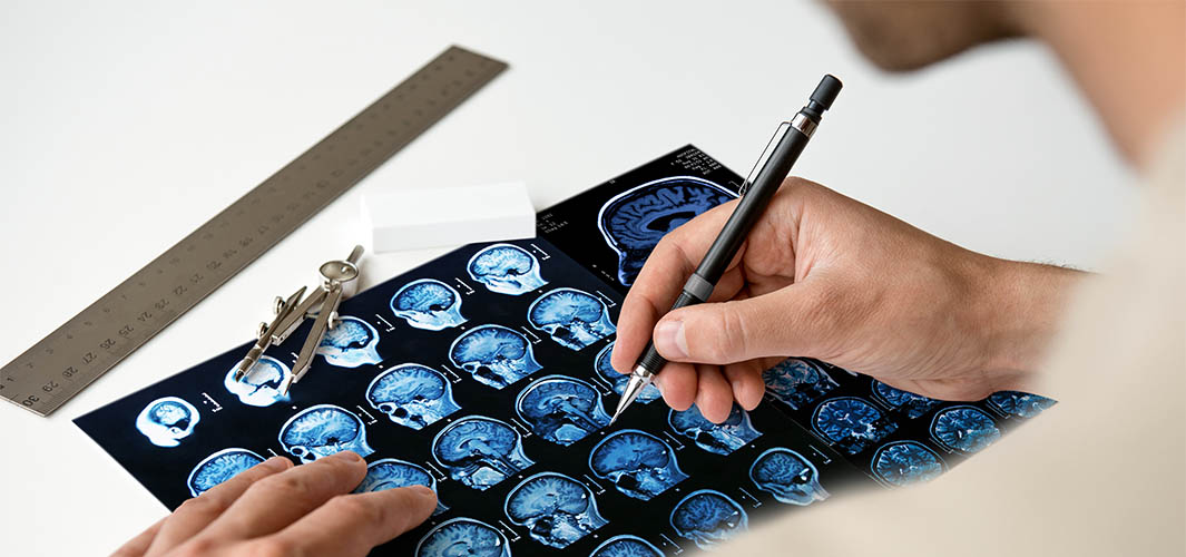 Limbic System Impairment and How it Affects Your Life