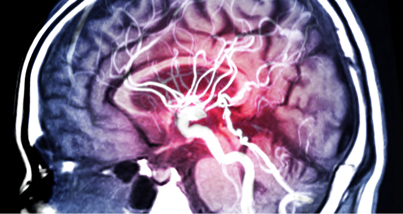 Brainspotting Training: An Exciting Advancement in Healing