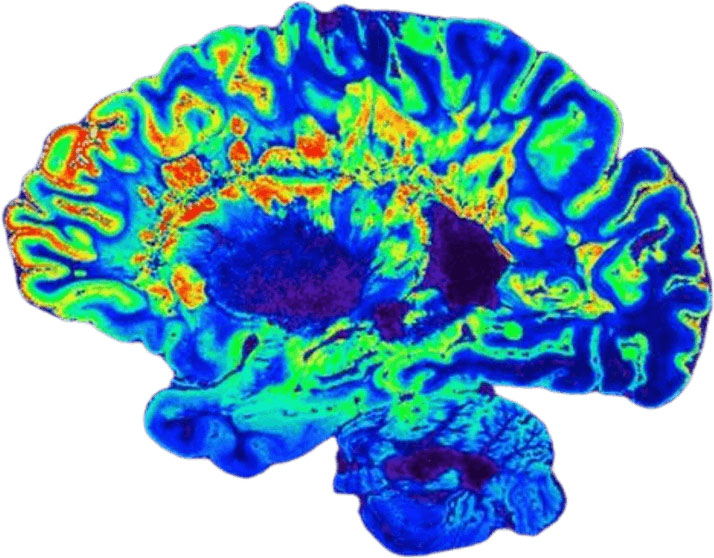 Brain graphic