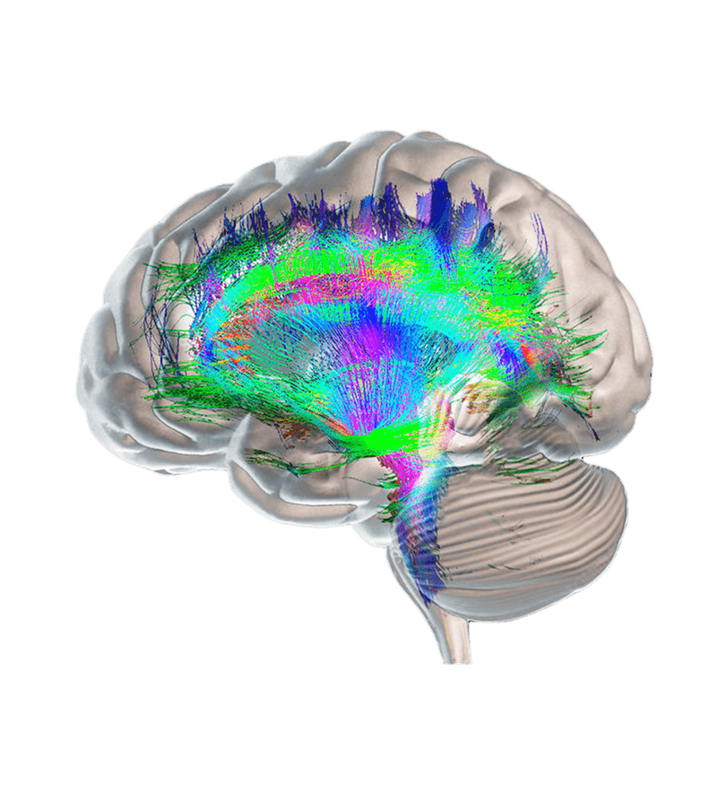 Brain graphic